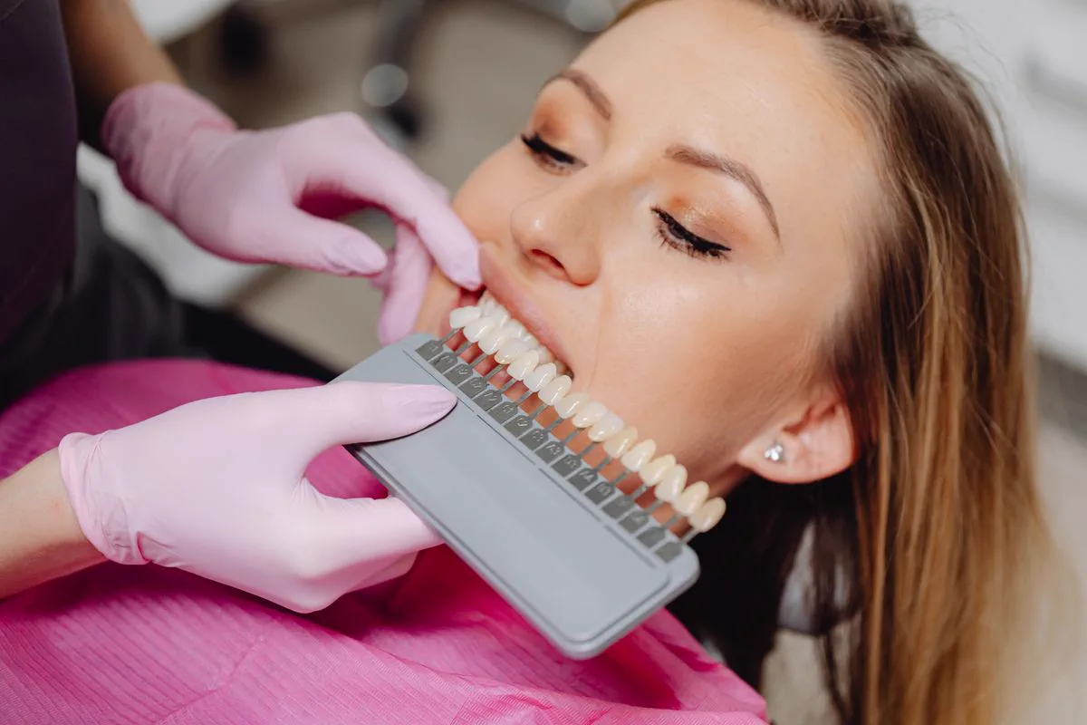 Imagen de referencia de una evaluación para blanqueamiento dental